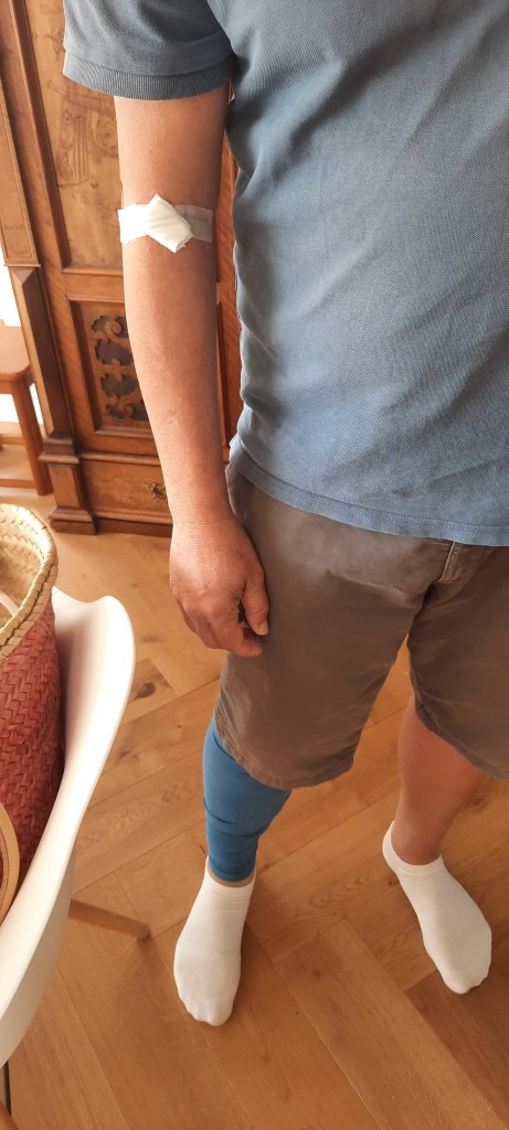 Operation gelungen! 12von12 August 2025 - Unterfreundenblog